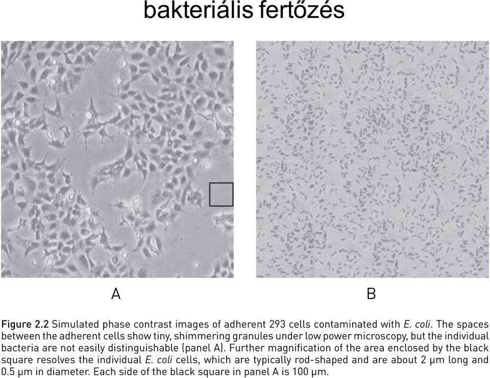 2 Simulated phase contrast images of adherent 293 cells contaminated with E. coli.