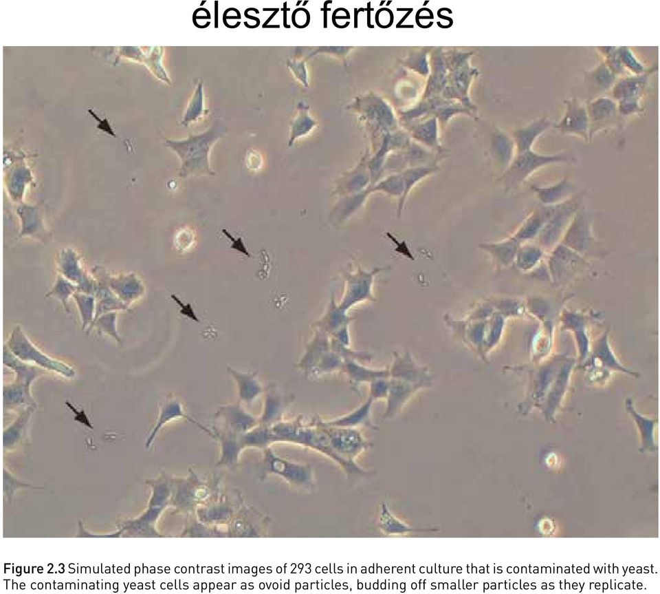 The simulated image below shows adherent 293 cell culture 24 hours after plating that is infected with yeast.