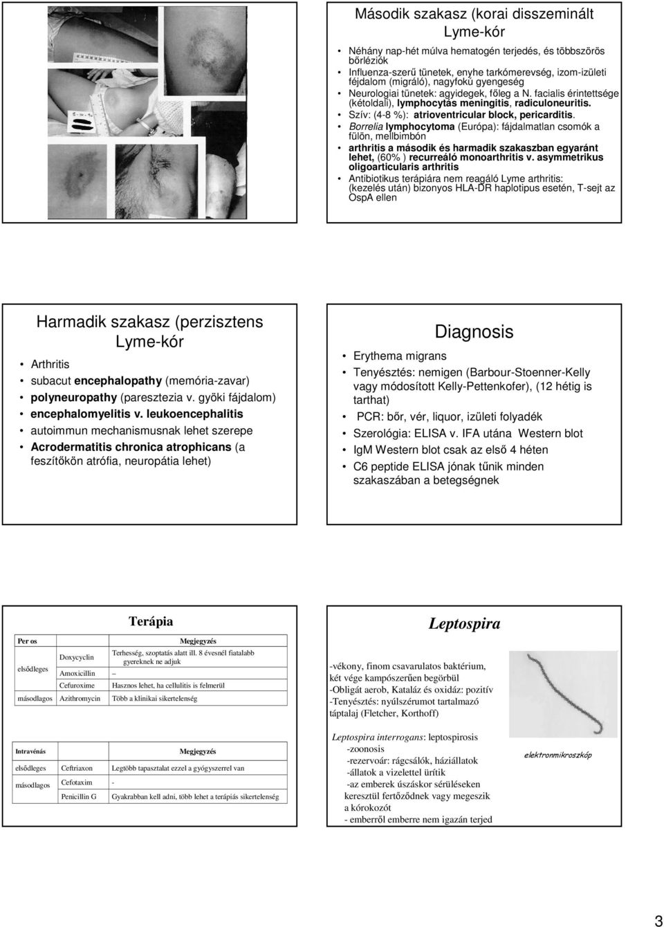 Borrelia lymphocytoma (Európa): fájdalmatlan csomók a fülön, mellbimbón arthritis a második és harmadik szakaszban egyaránt lehet, (60% ) recurreáló monoarthritis v.