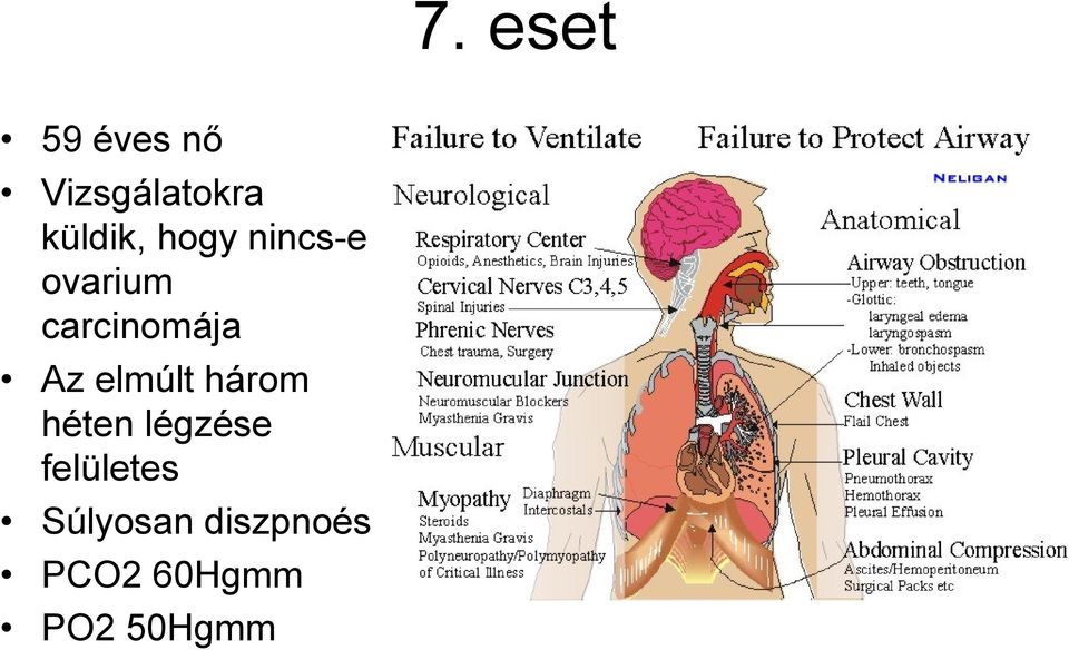 carcinomája Az elmúlt három héten