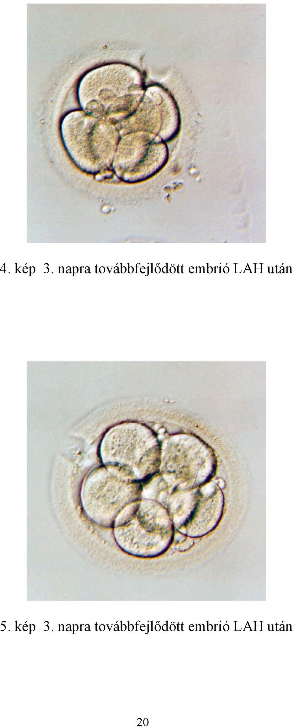 embrió LAH után 5. kép 3.