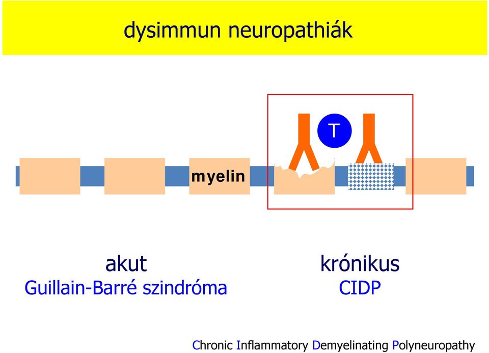 krónikus CIDP Chronic