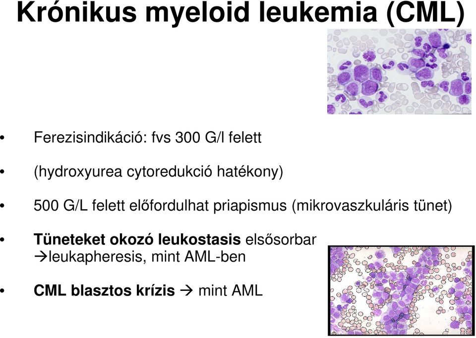 priapismus (mikrovaszkuláris tünet) Tüneteket okozó leukostasis