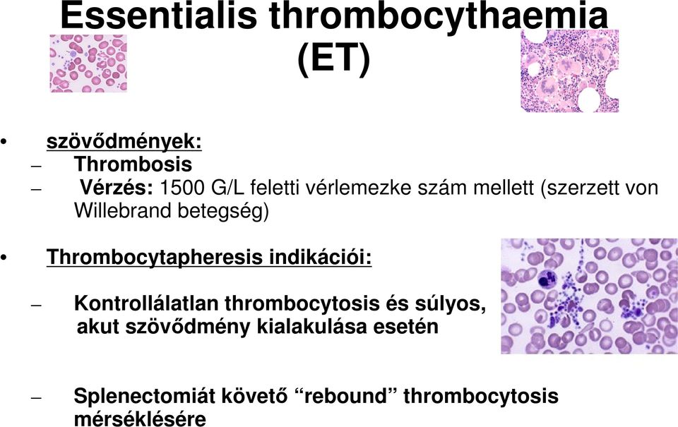 Thrombocytapheresis indikációi: Kontrollálatlan thrombocytosis és súlyos,