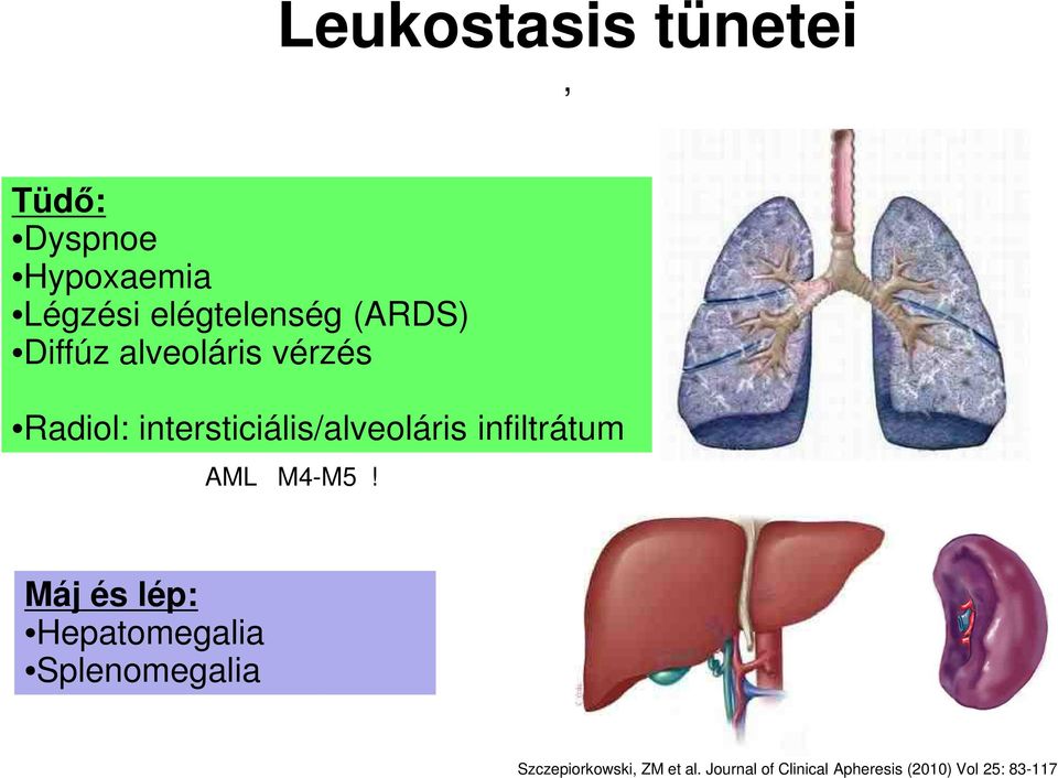 infiltrátum (AML M4-M5!