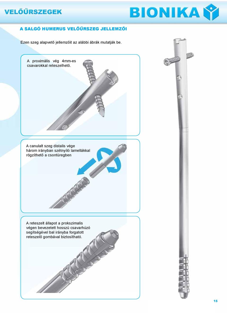 A canulalt szeg distalis vége három irányban szétnyíló lamellákkal rögzíthető a csontüregbenn