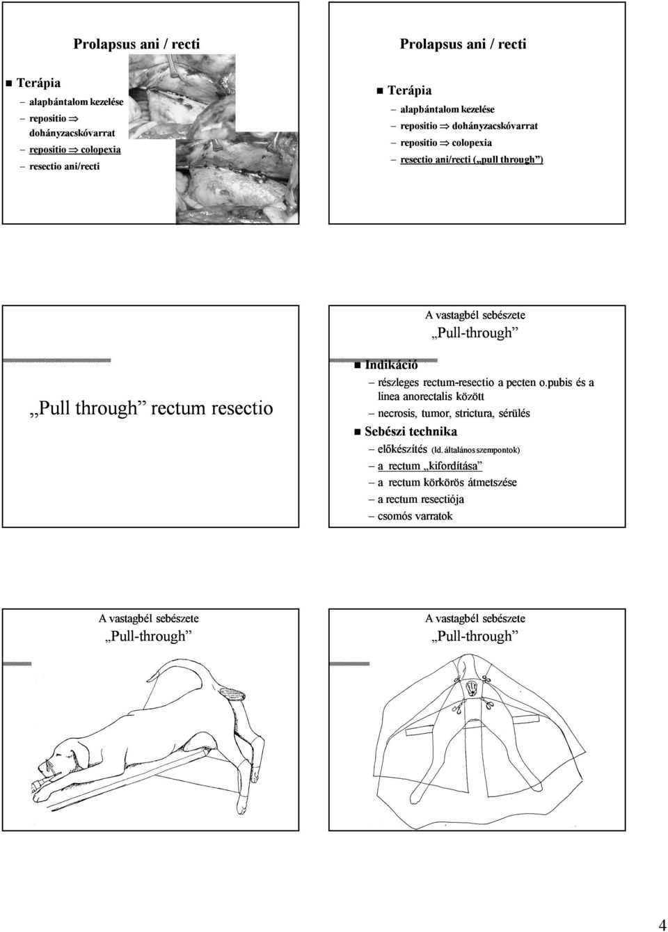 rectum-resectio resectio a pecten o.