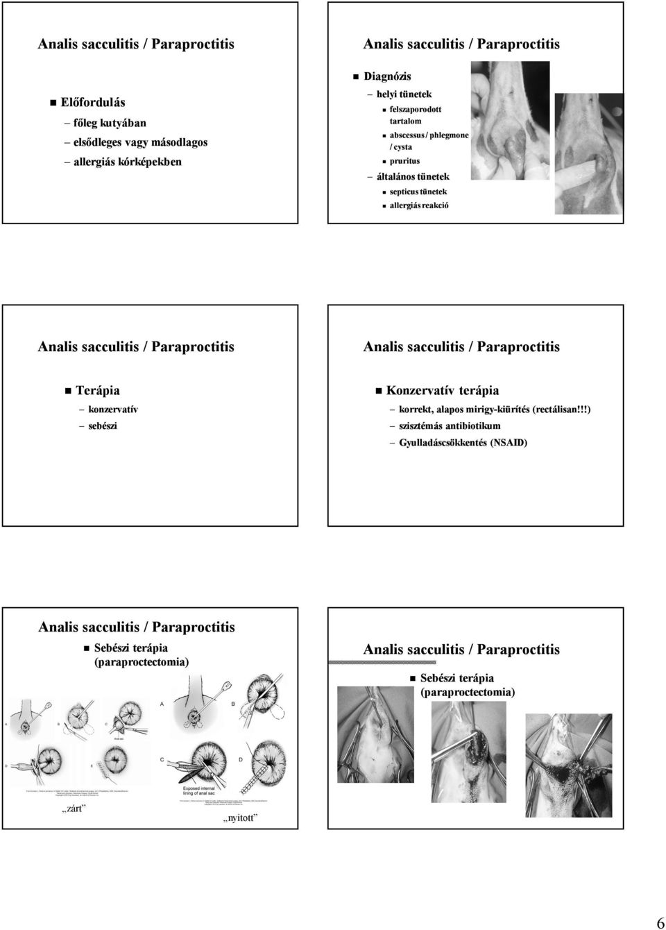 Analis sacculitis / Paraproctitis konzervatív sebészi Konzervatív terápia korrekt, alapos mirigy-kiürítés (rectálisan!