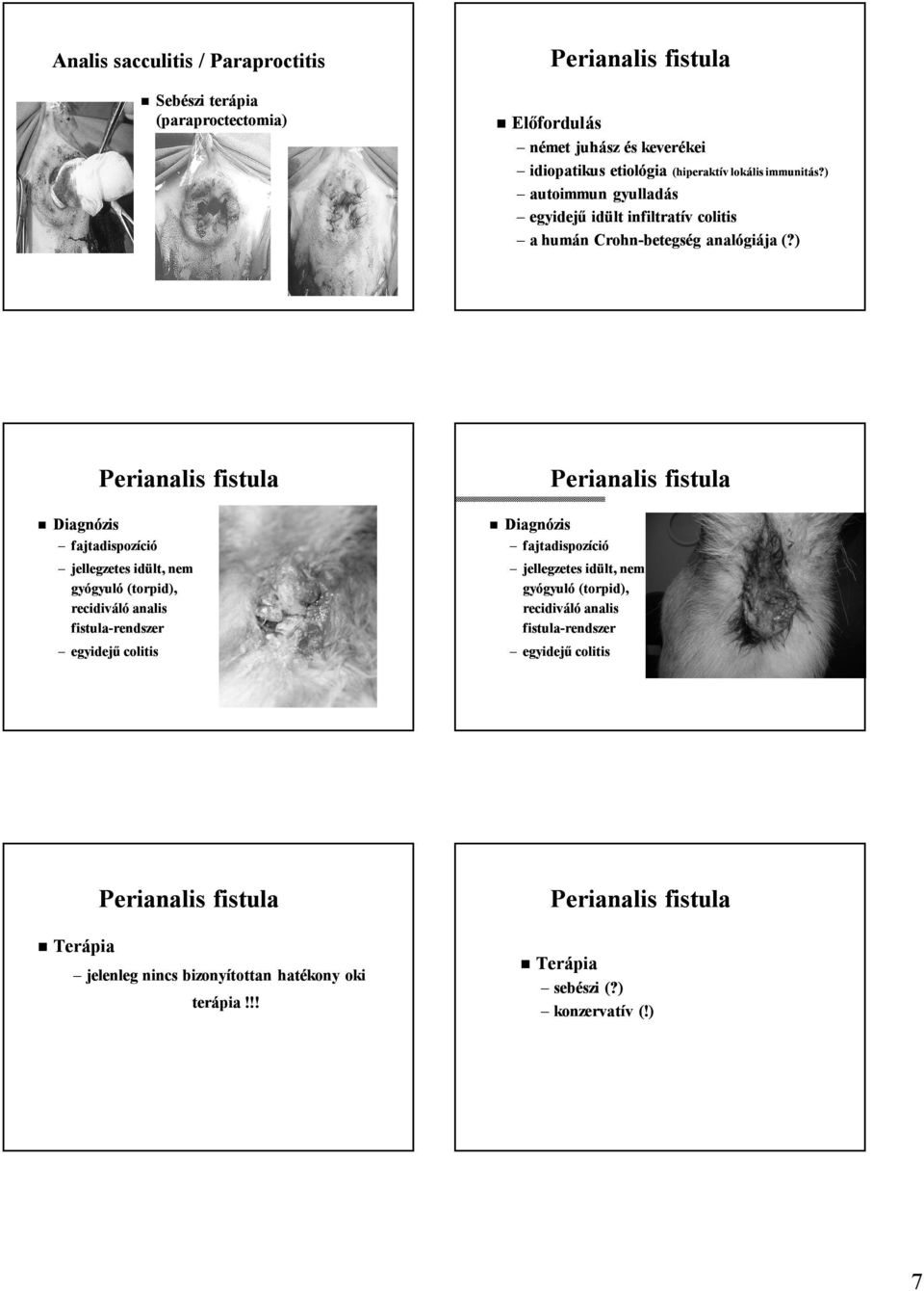 ) Diagnózis Perianalis fistula fajtadispozíció jellegzetes idült, nem gyógyuló (torpid), recidiváló analis fistula-rendszer egyidejű colitis Diagnózis Perianalis
