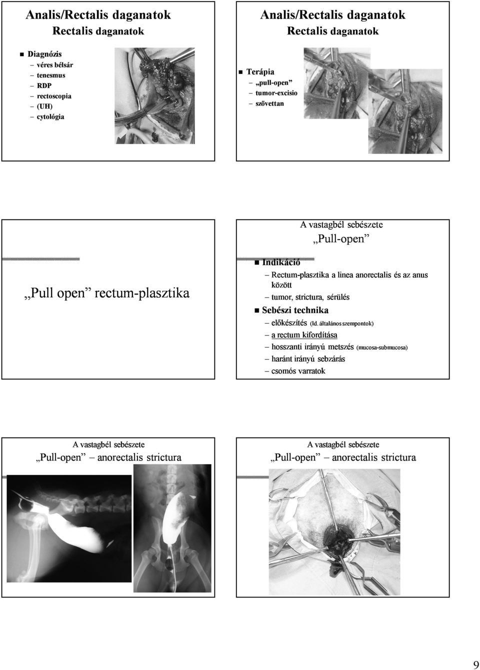 sérülés open rectumrectum-plasztika Sebészi technika előkészítés (ld.