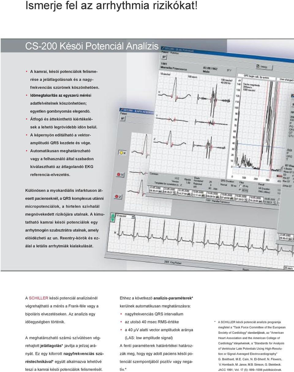 A képernyön editálható a vektoramplitudó QRS kezdete és vége. Automatikusan meghatározható vagy a felhasználó által szabadon kiválasztható az átlagolandó EKG referencia-elvezetés.