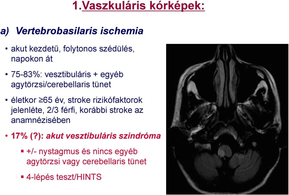 Vaszkuláris kórképek: életkor 65 év, stroke rizikófaktorok jelenléte, 2/3 férfi, korábbi