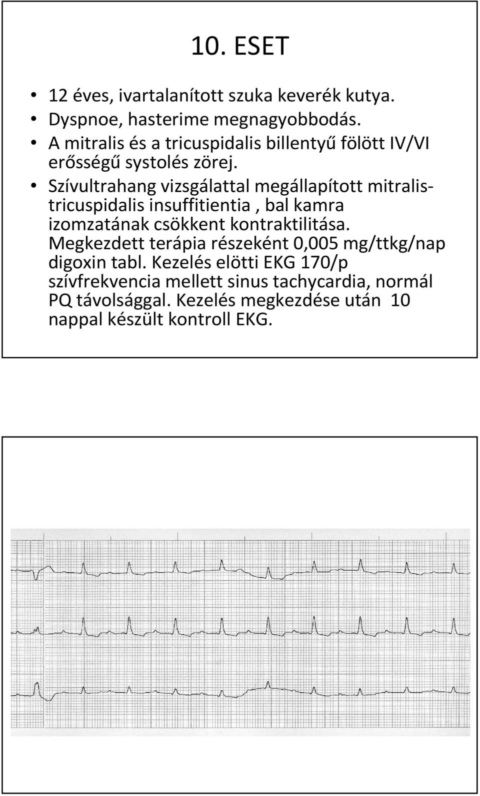 Szívultrahang vizsgálattal megállapított mitralistricuspidalis insuffitientia, bal kamra izomzatának csökkent