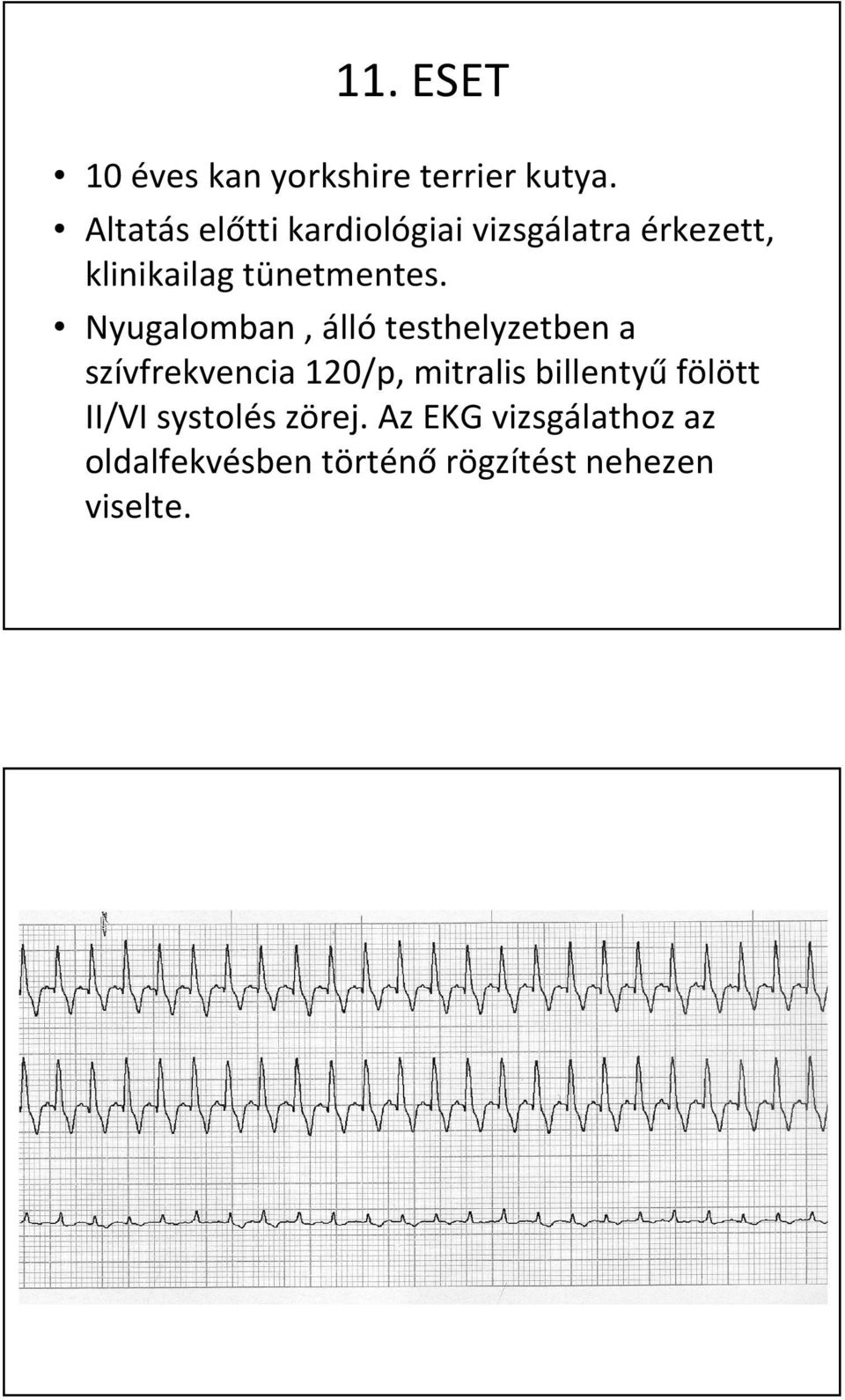 Nyugalomban, álló testhelyzetben a szívfrekvencia 120/p, mitralis