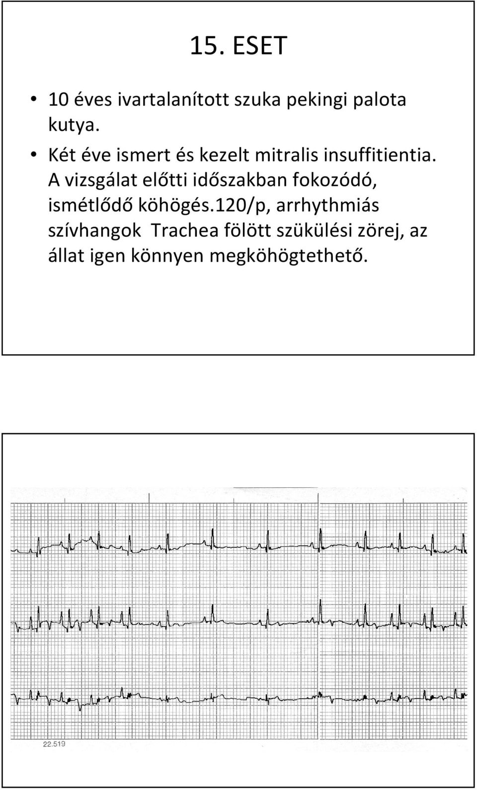 A vizsgálat előtti időszakban fokozódó, ismétlődő köhögés.