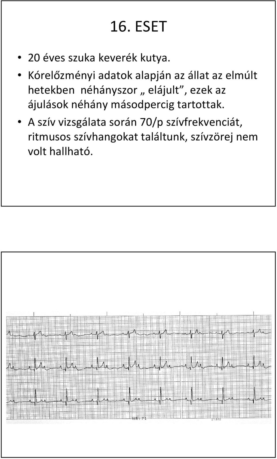 elájult, ezek az ájulások néhány másodpercig tartottak.