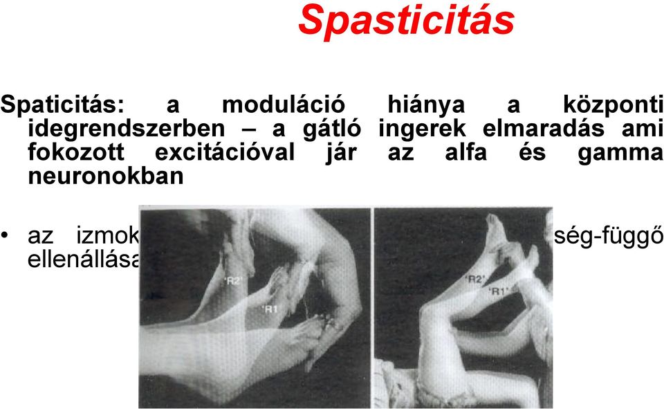 fokozott excitációval jár az alfa és gamma