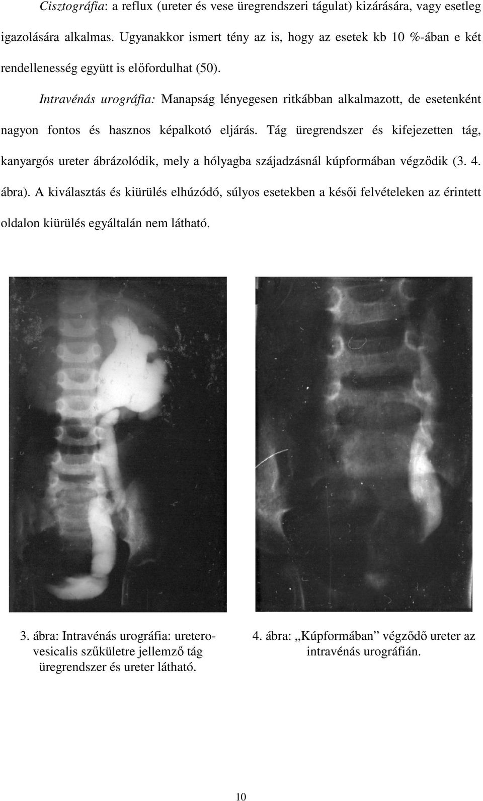 Intravénás urográfia: Manapság lényegesen ritkábban alkalmazott, de esetenként nagyon fontos és hasznos képalkotó eljárás.