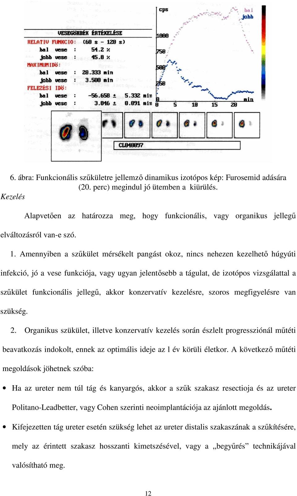 Amennyiben a szőkület mérsékelt pangást okoz, nincs nehezen kezelhetı húgyúti infekció, jó a vese funkciója, vagy ugyan jelentısebb a tágulat, de izotópos vizsgálattal a szőkület funkcionális