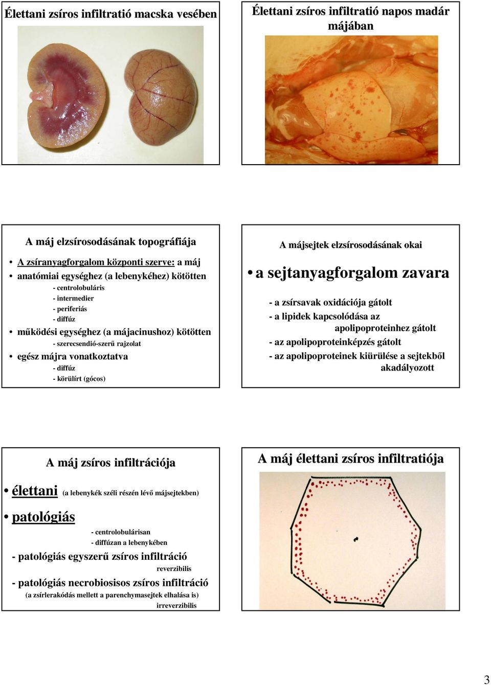 - körülírt (gócos) A májsejtek m elzsírosod rosodásának okai a sejtanyagforgalom zavara - a zsírsavak oxidációja gátolt - a lipidek kapcsolódása az apolipoproteinhez gátolt - az apolipoproteinképzés