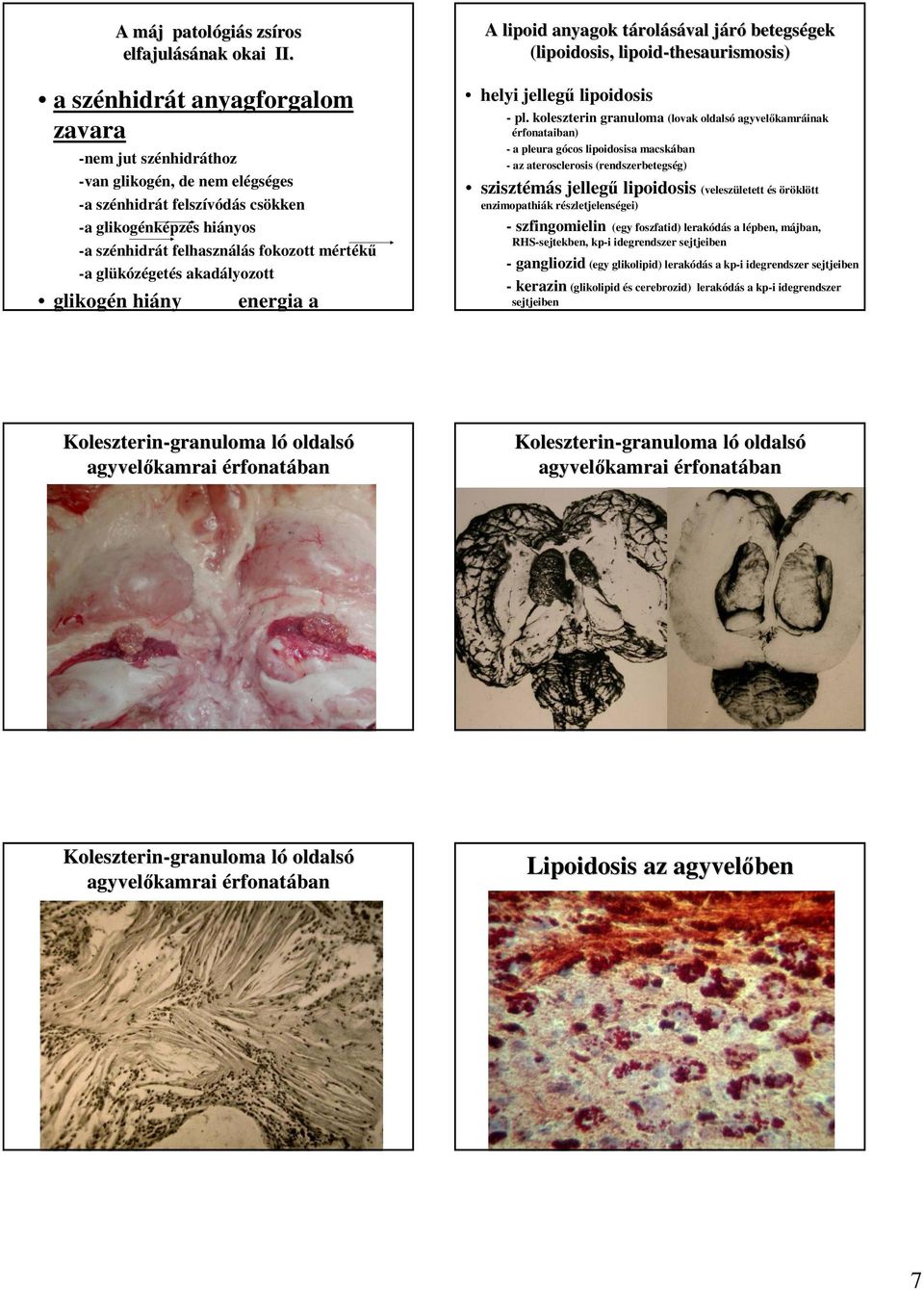 glükózégetés akadályozott glikogén hiány energia a A lipoid anyagok tárolt rolásával járój betegségek gek (lipoidosis, lipoid-thesaurismosis thesaurismosis) helyi jellegő lipoidosis - pl.