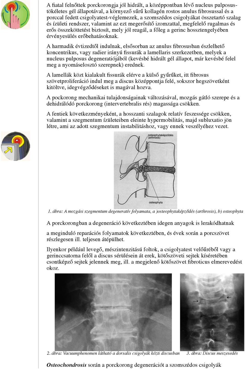 főleg a gerinc hossztengelyében érvényesülés erőbehatásoknak.