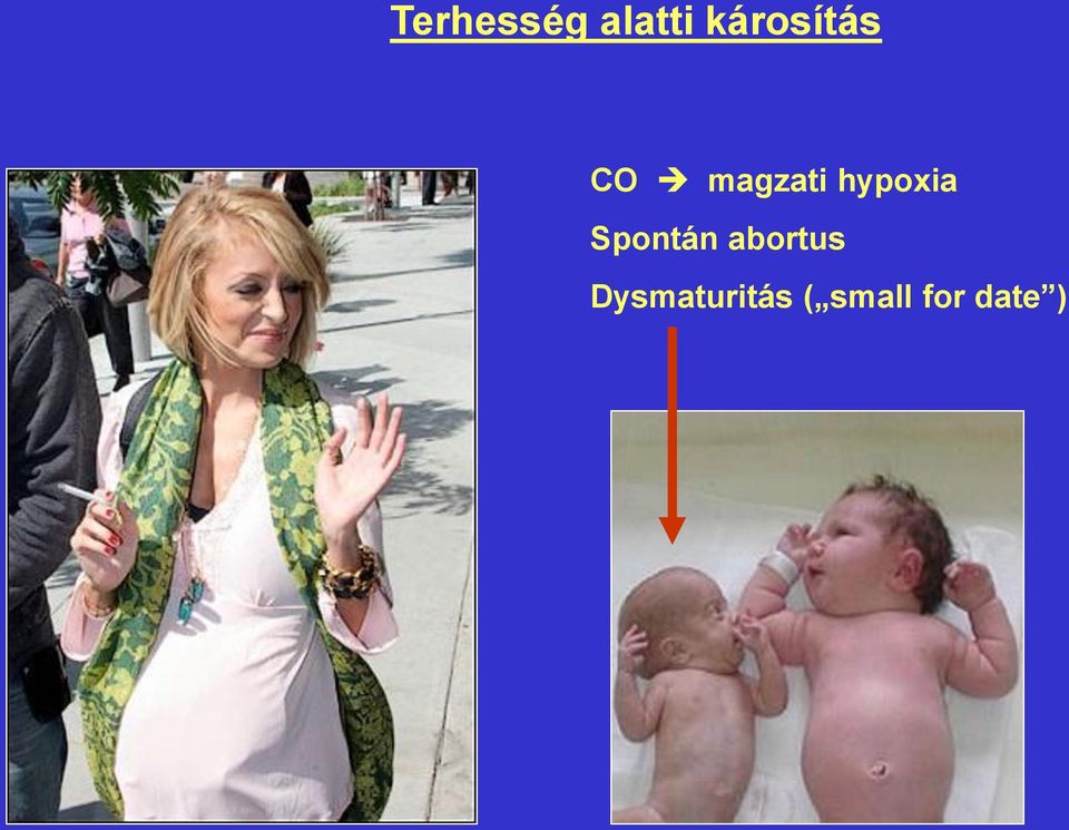 hypoxia Spontán abortus