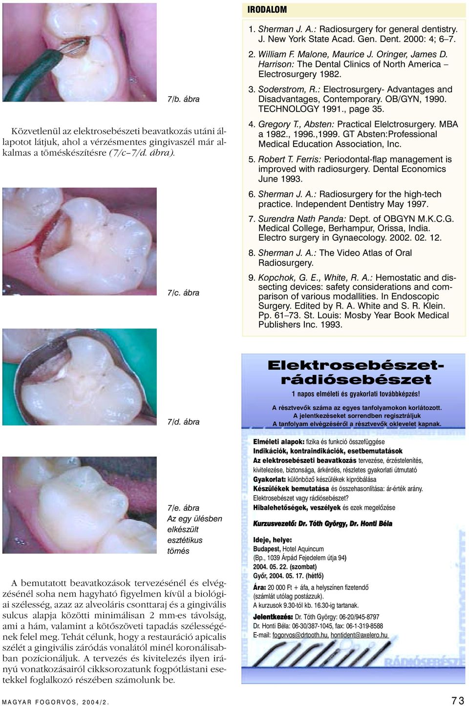 Harrison: The Dental Clinics of North America Electrosurgery 1982. 3. Soderstrom, R.: Electrosurgery- Advantages and Disadvantages, Contemporary. OB/GYN, 1990. TECHNOLOGY 1991., page 35. 4. Gregory T.