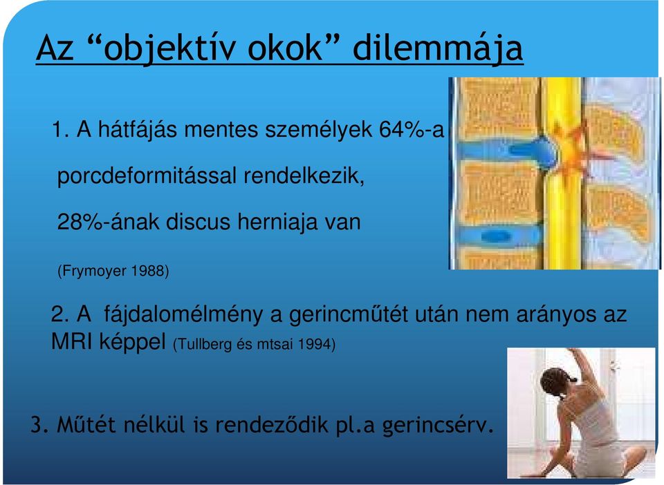 28%-ának discus herniaja van (Frymoyer 1988) 2.