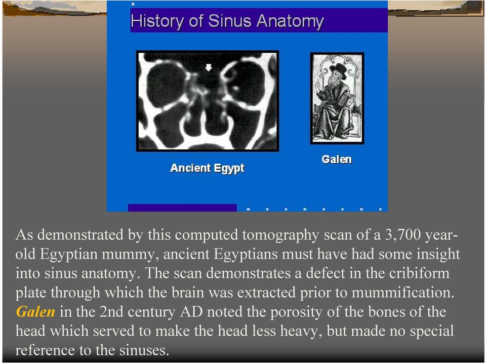 The scan demonstrates a defect in the cribiform plate through which the brain was extracted prior to