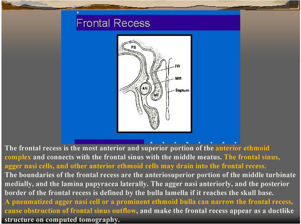 The boundaries of the frontal recess are the anteriosuperior portion of the middle turbinate medially, and the lamina papyracea laterally.