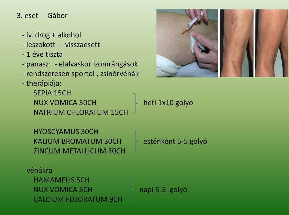 rendszeresen sportol, zsinórvénák - therápiája: SEPIA 15CH NUX VOMICA 30CH NATRIUM CHLORATUM