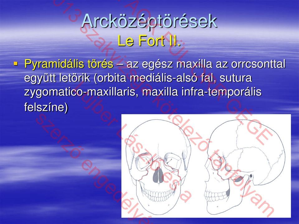 orrcsonttal együtt letörik (orbita