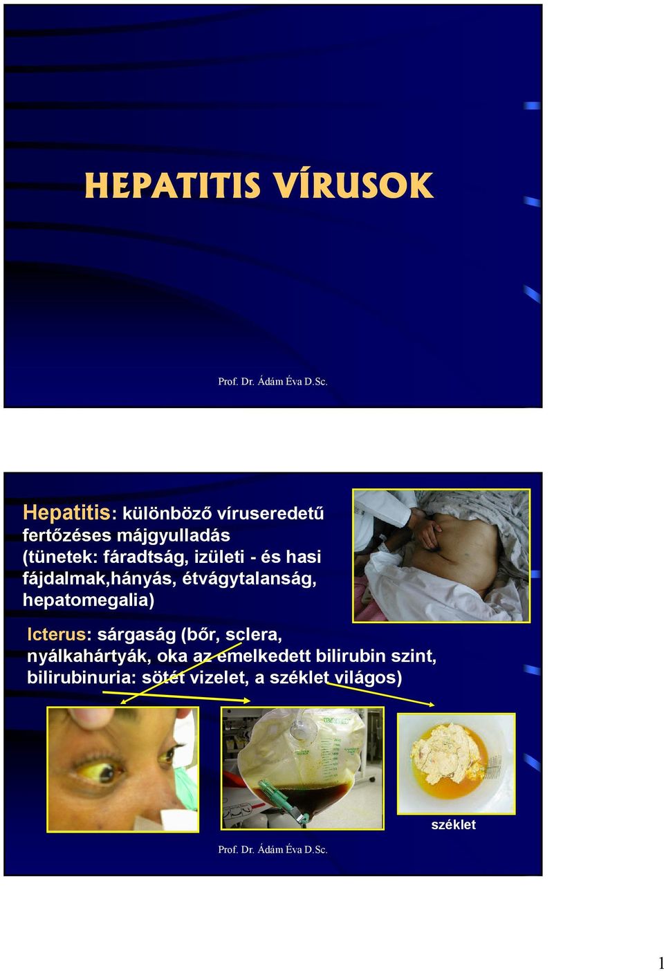 hepatomegalia) Icterus: sárgaság (bır, sclera, nyálkahártyák, oka az