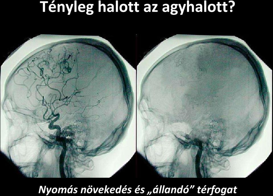 Nyomás növekedés