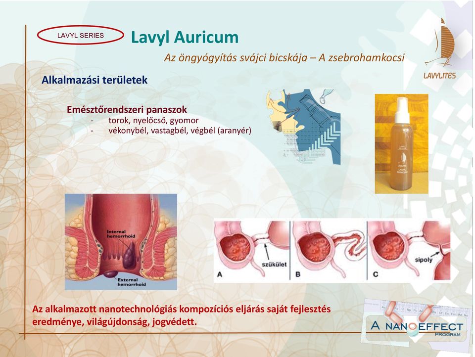 nyelőcső, gyomor vékonybél, vastagbél, végbél (aranyér) Az alkalmazott