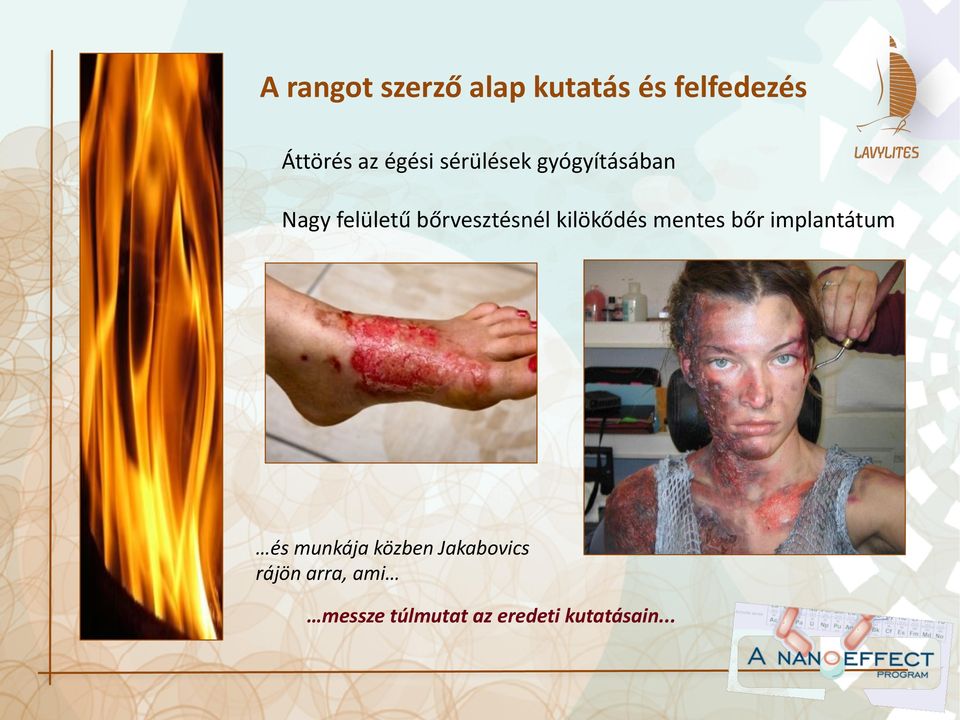kilökődés mentes bőr implantátum és munkája közben
