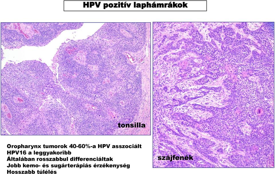 leggyakoribb Általában rosszabbul differenciáltak