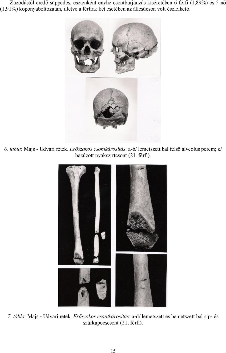 Erőszakos csontkárosítás: a-b/ lemetszett bal felső alveolus perem; c/ bezúzott nyakszirtcsont (21. férfi). 7.