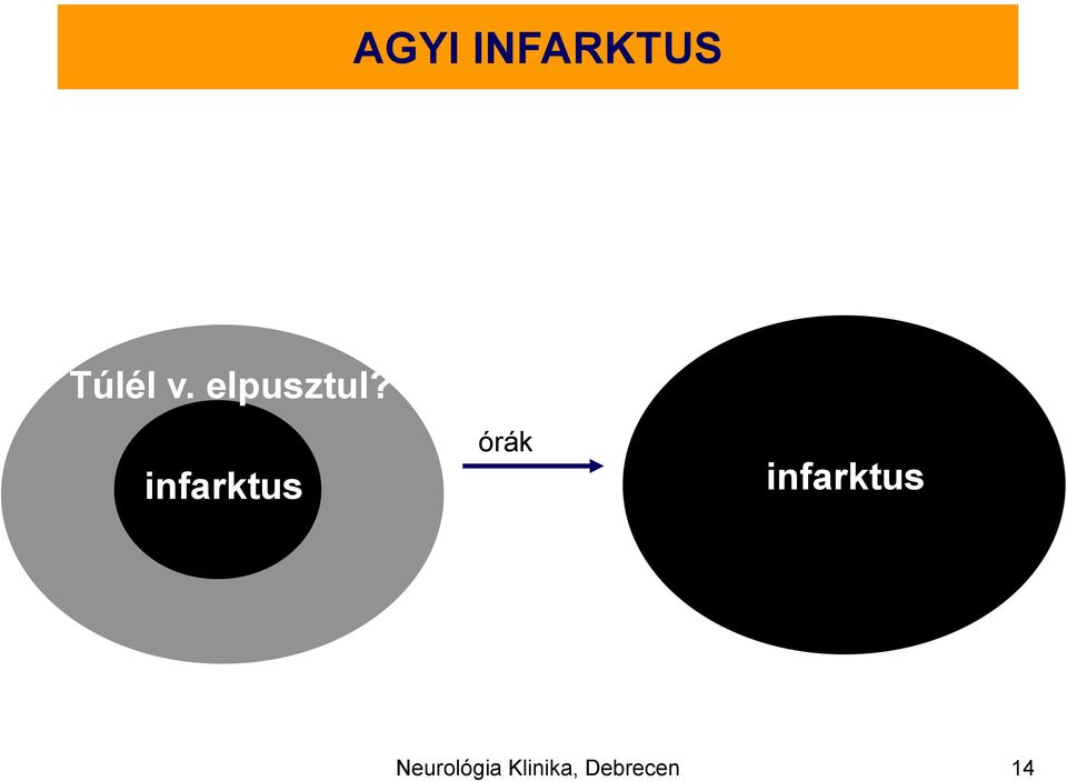 infarktus órák