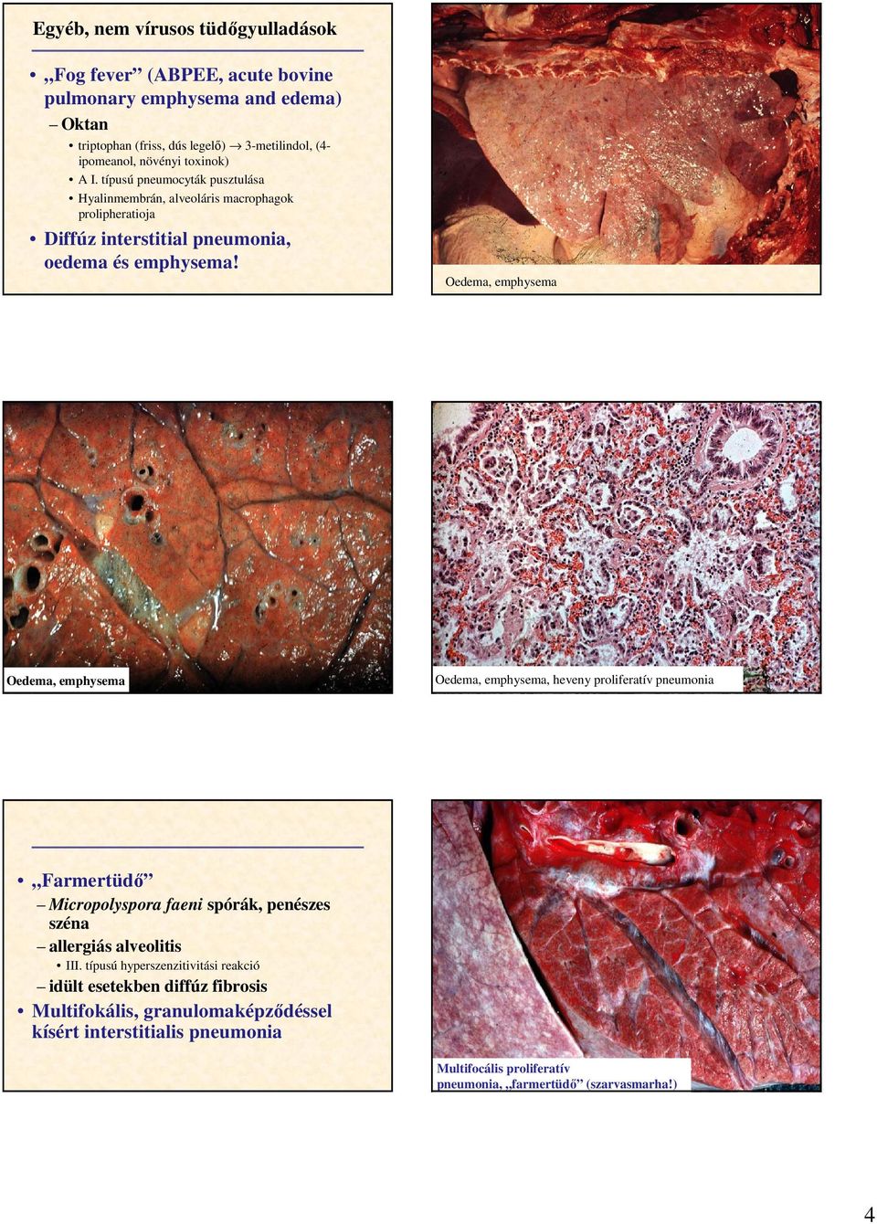 Oedema, emphysema Oedema, emphysema Oedema, emphysema, heveny proliferatív pneumonia Farmertüdı Micropolyspora faeni spórák, penészes széna allergiás alveolitis III.