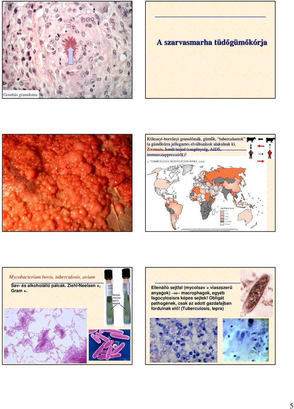 x Mycobacterium bovis, tuberculosis, avium Sav- és alkoholálló pálcák. Ziehl-Neelsen +, Gram +.