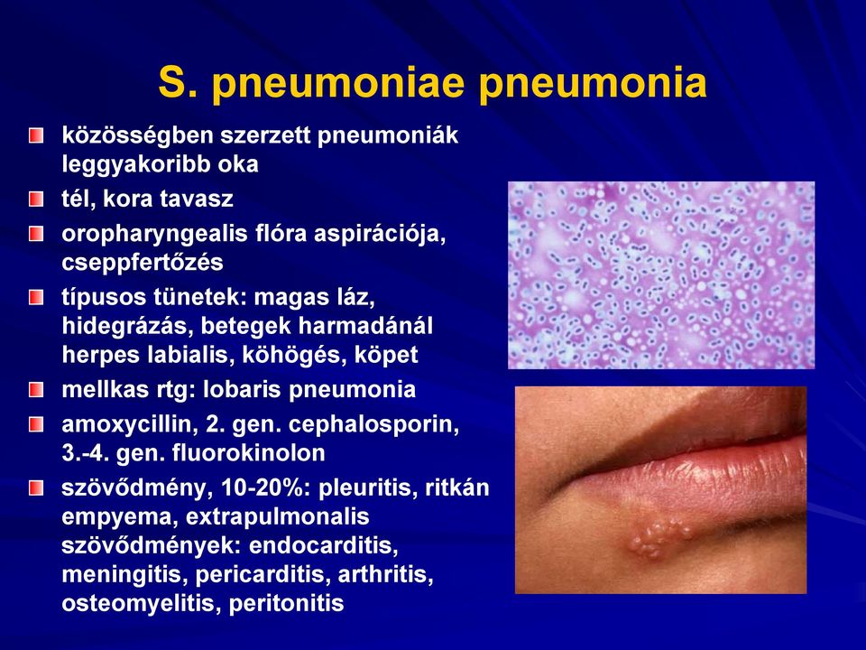 mellkas rtg: lobaris pneumonia amoxycillin, 2. gen.