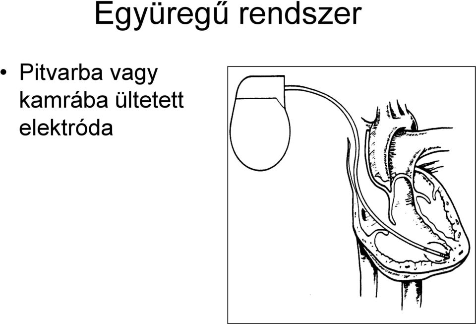 Pitvarba vagy