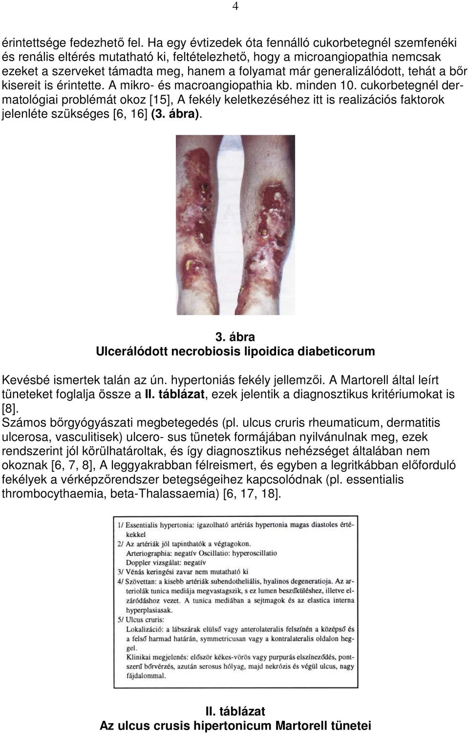 generalizálódott, tehát a bır kisereit is érintette. A mikro- és macroangiopathia kb. minden 10.