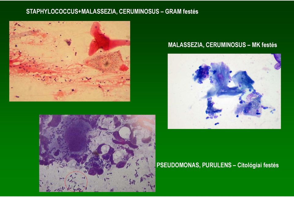 MALASSEZIA, CERUMINOSUS MK