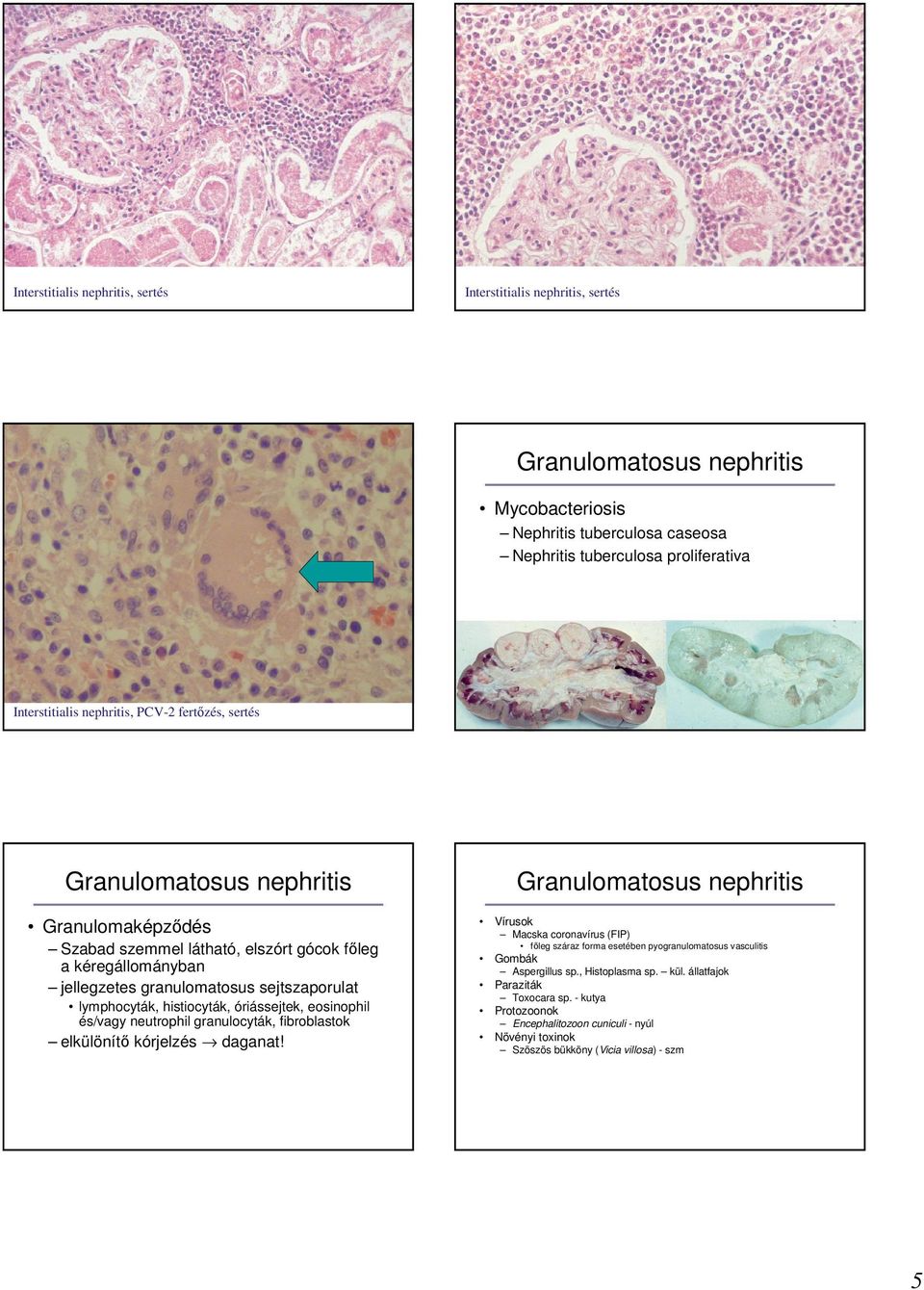 óriássejtek, eosinophil és/vagy neutrophil granulocyták, fibroblastok elkülönítı kórjelzés daganat!