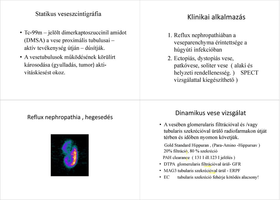 Ectopiás, dystopiás vese, patkóvese, soliter vese ( alaki és helyzeti rendellenesség.