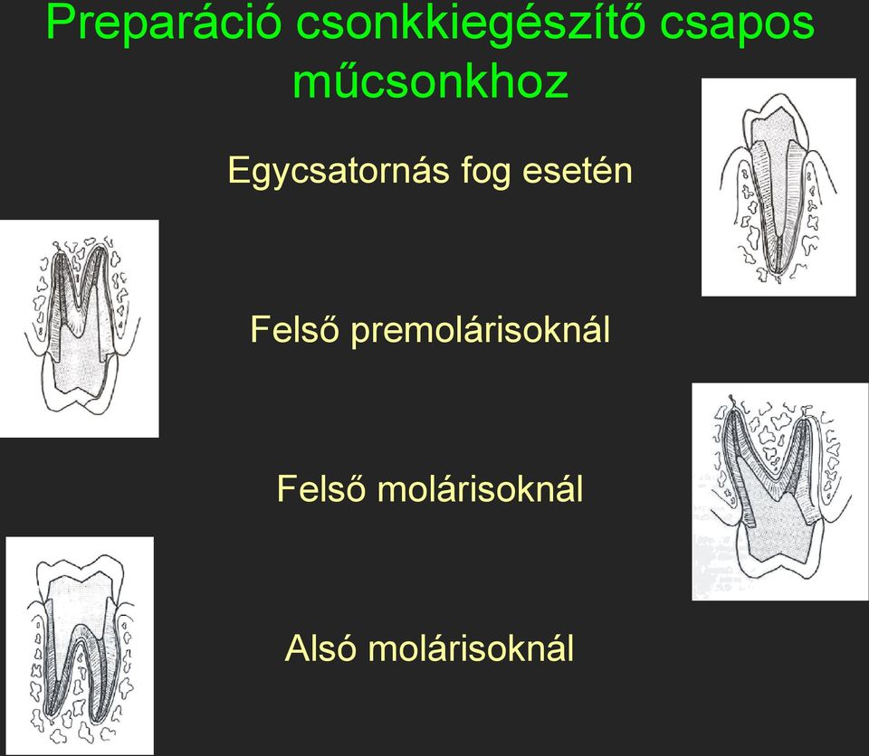 fog esetén Felső