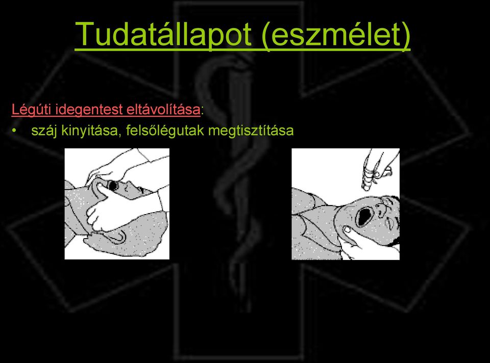 eltávolítása: száj